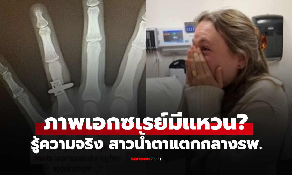 สาวอึ้ง! ดูภาพเอกซเรย์เจอแหวนเพชร หันมาเจอเซอร์ไพรส์ น้ำตาแตกกลางห้องฉุกเฉิน