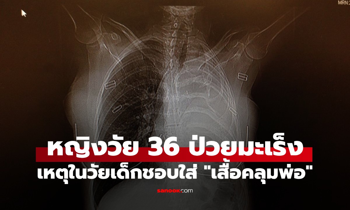สาววัย 36 ช็อก! หมอบอกเหลือเวลาชีวิตแค่ 15 เดือน เหตุวัยเด็กชอบใส่ "เสื้อคลุมพ่อ"