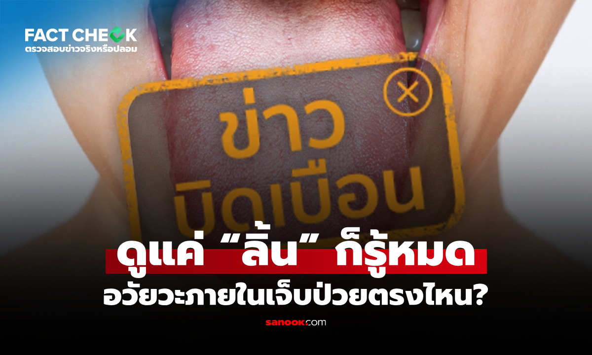 ดูแค่ “ลิ้น” แล้วรู้โรคอวัยวะภายในได้จริงหรือไม่? : เช็กข่าวชัวร์