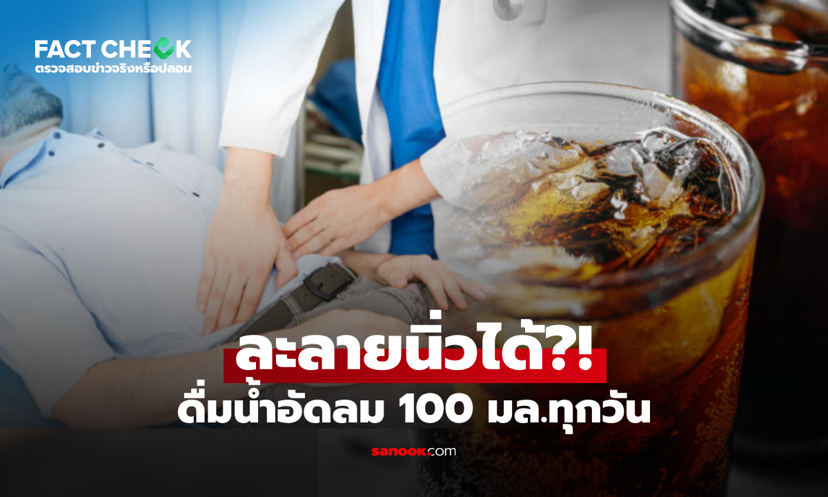 "ดื่มน้ำอัดลม 100 มล.ทุกวัน ละลายนิ่วได้ ไม่ต้องผ่าตัด" หมอเฉลยจริงหรือไม่? : เช็กข่าวชัวร์