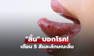 5 สัญญาณบน "ลิ้น" เตือนภัยโรคร้ายแรง ตั้งแต่ตับ-เบาหวาน-อัมพฤกษ์ ไปจนถึงมะเร็ง เช็กที่นี่!