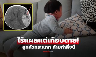 อุทาหรณ์! ทารก 6 เดือนตกโซฟา ไม่มีแผลแต่เกือบตาย เพราะ 1 สิ่งที่หลายครอบครัวทำ