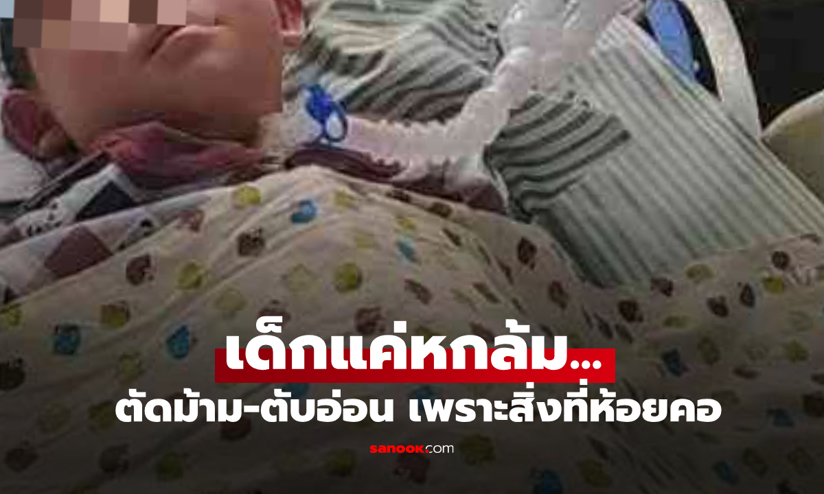 เด็ก 7 ขวบ ต้องตัดม้าม-ตับอ่อน หลังล้มโดยมี "1 สิ่ง" ห้อยคออยู่ อุทาหรณ์เตือนทุกบ้าน!