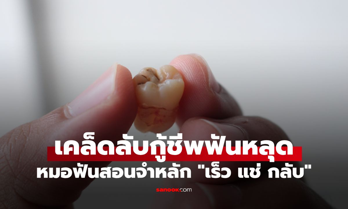 รู้ไว้ก่อนสาย! ทันตแพทย์สอนเคล็ดลับกู้ชีพฟันหลุด จำ 3 คำง่าย ๆ "เร็ว แช่ กลับ"