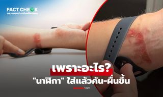 "นาฬิกา" ใส่แล้วคัน-ผื่นขึ้น เป็นเพราะแพ้สายจริงหรือ? เฉลยสาเหตุที่ถูกมองข้าม! : เช็กข่าวชัวร์