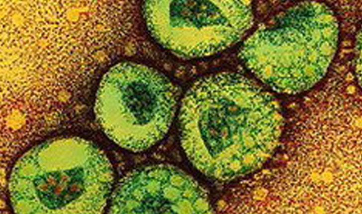 พบผู้ป่วยติดเชื้อไวรัสซาร์สรายที่2ในฝรั่งเศส