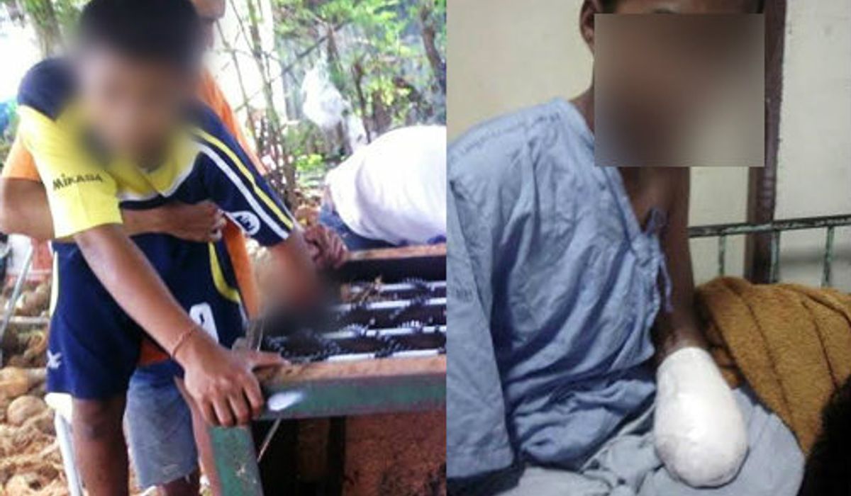 เด็กชายกตัญญูไร้น้ำตา แม้แพทย์ตัดมือที่ถูกบด