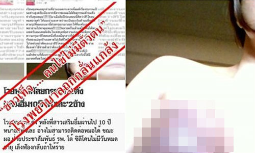 รพ.ยันฮี โต้ข่าวศัลยกรรมนมเน่า ชี้คนไข้ไม่มีจริง-ถูกกลั่นแกล้ง