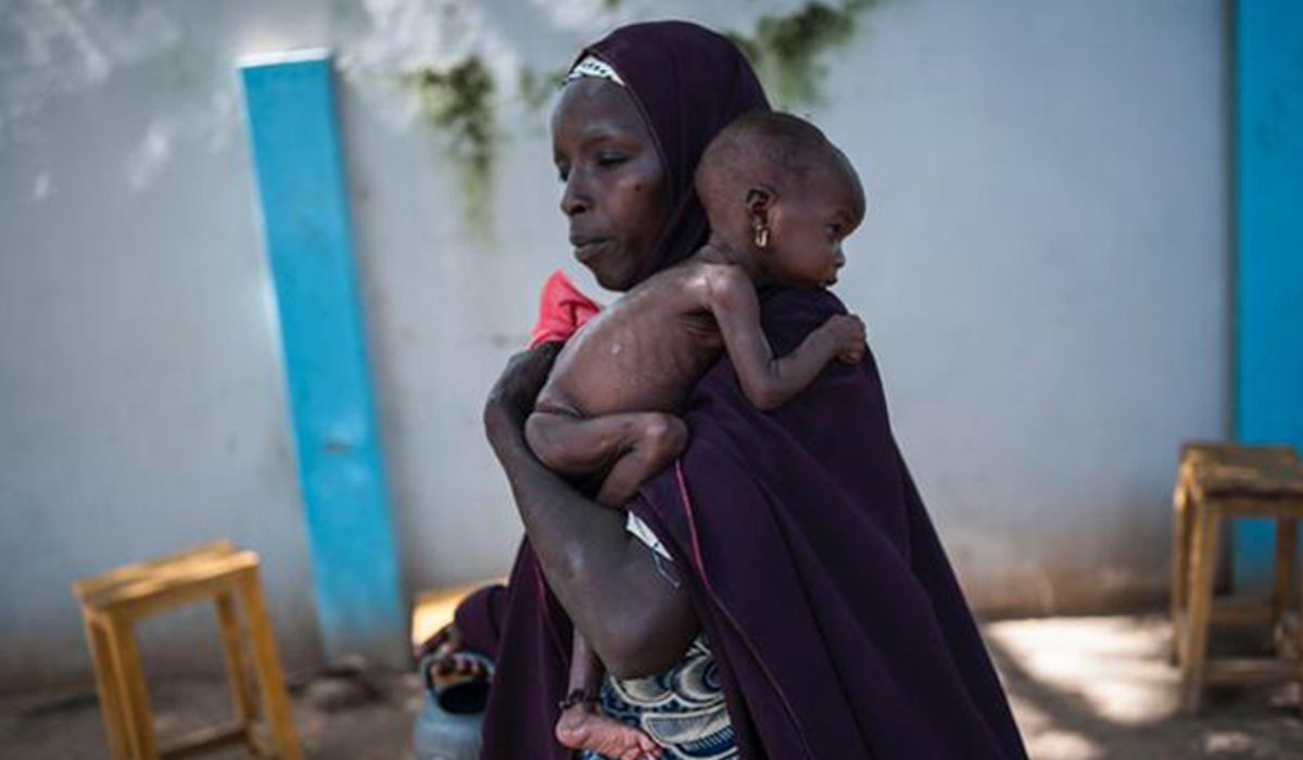 ภาพน่าเศร้า!! สถานการณ์เด็กขาดอาหารในไนจีเรียกำลังวิกฤติ