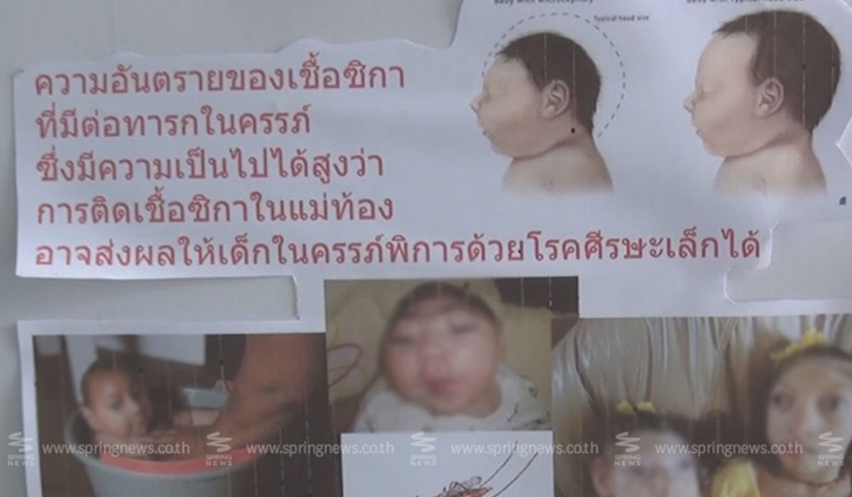 สธ.เผย! 2 ทารกศีรษะเล็กเกิดจาก “ซิกา” พบเป็นครั้งแรกในไทย