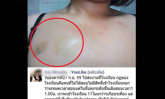 สุดฉาว! ‘นักเรียนสาว’ ร้อง ถูก ‘ครูชาย รร.ดังชัยนาท’ ทำร้ายบาดเจ็บ