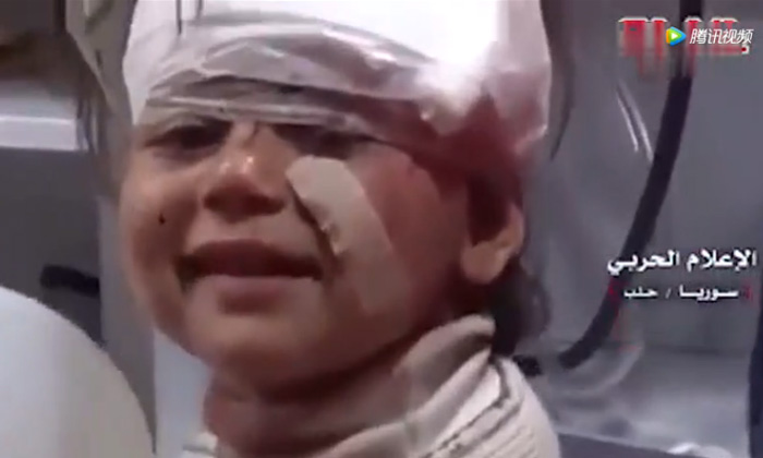 สะเทือนใจ! รอยยิ้มเด็กหญิงซีเรีย หลังเจ็บจากเหตุระเบิดรถผู้อพยพ