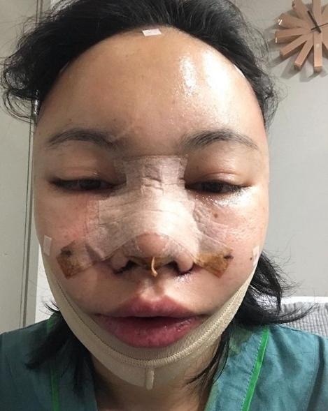 เอมมี่ อมลวรรณ