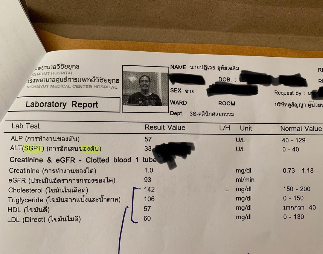 ฟองเบียร์ ปฏิเวธ