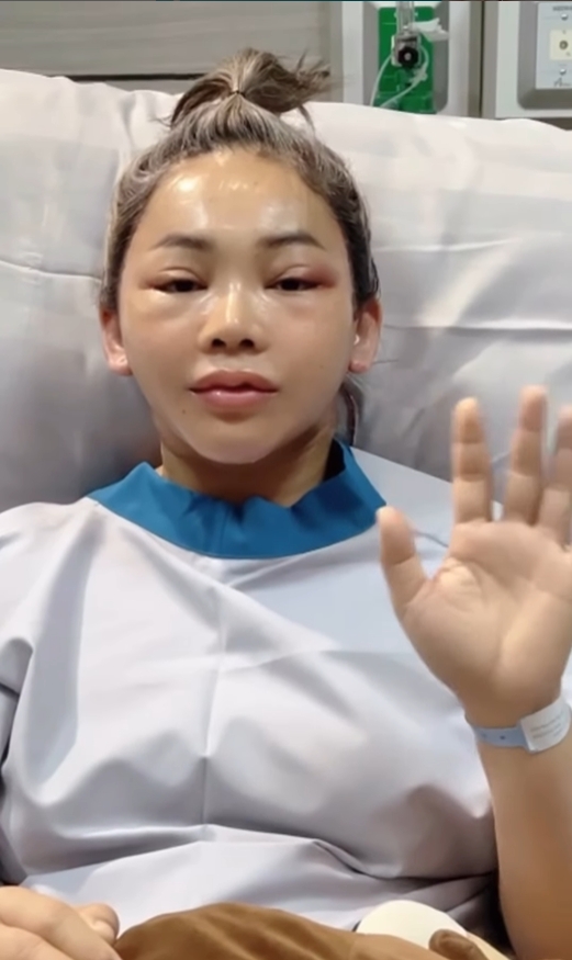 ตั๊กแตน ชลดา