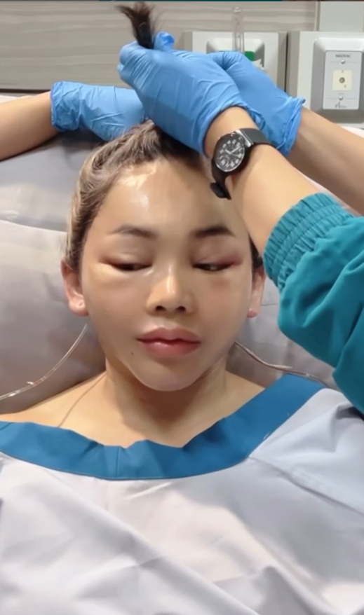 ตั๊กแตน ชลดา