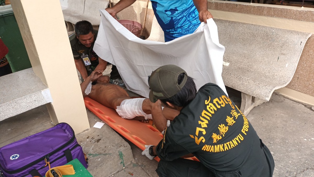 หนุ่มวัย 33 ฉีดแอลกอฮอล์ล้างมือก่อนจุดไฟจะดูดบุหรี่ ไฟลุกติดตามตัวเจ็บ