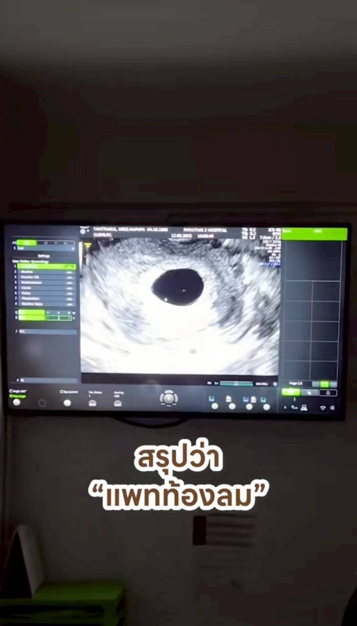 แพท ณปภา