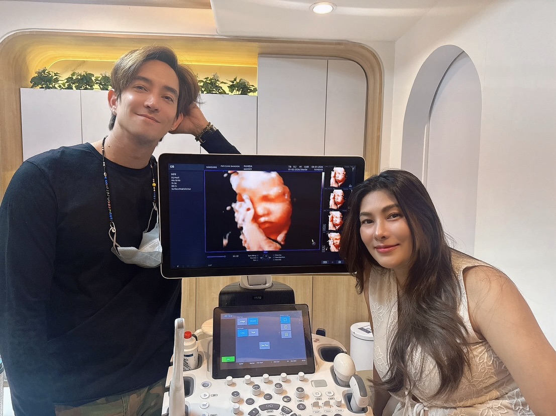 นุ่น หลุยส์