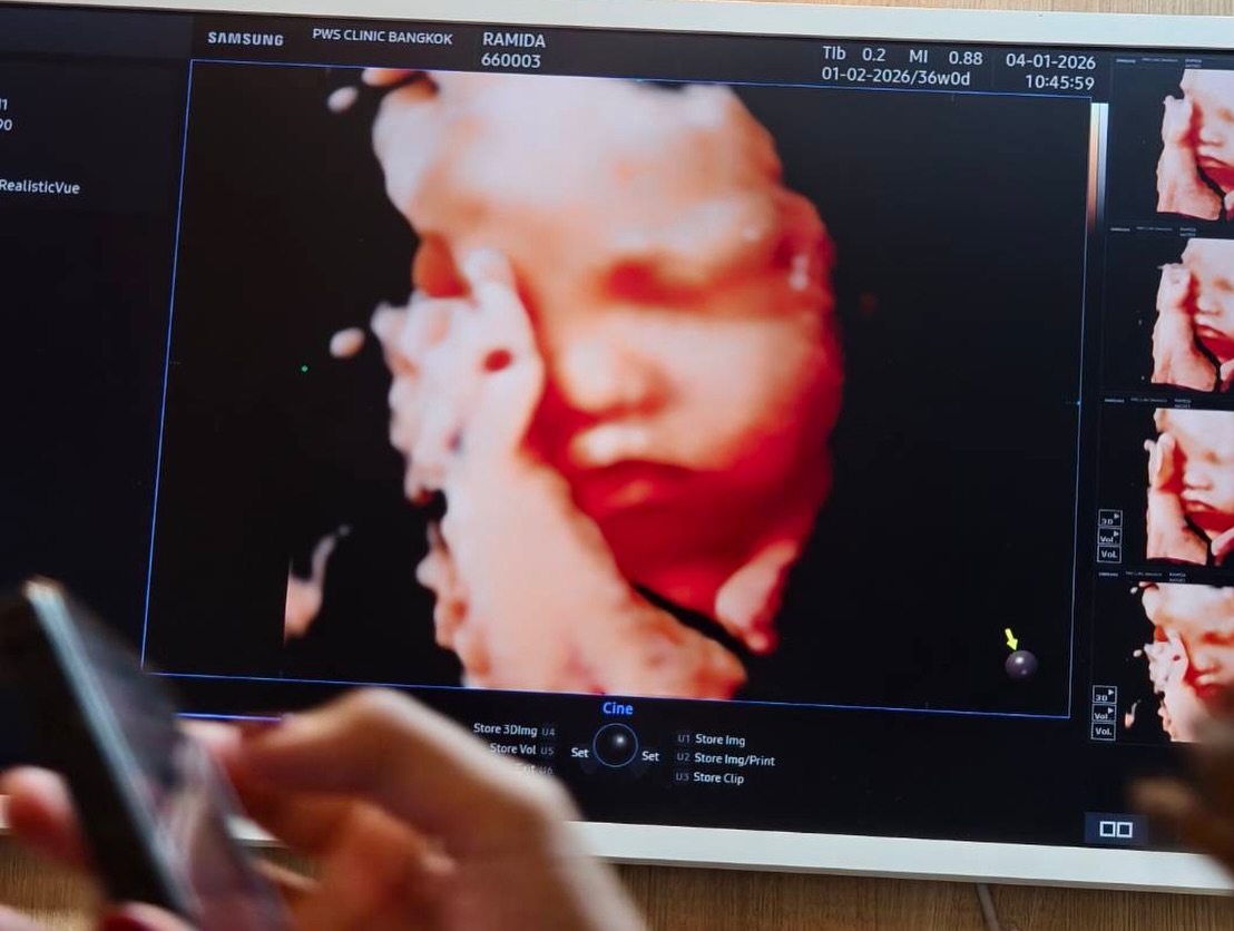 นุ่น หลุยส์