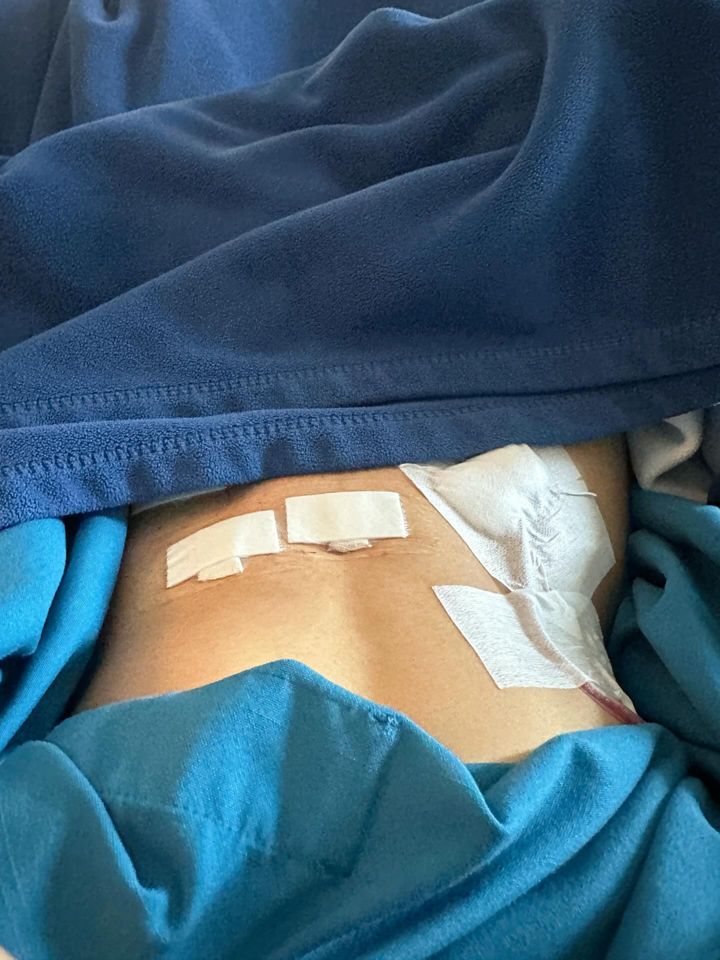 อุ้ม ทวีพร