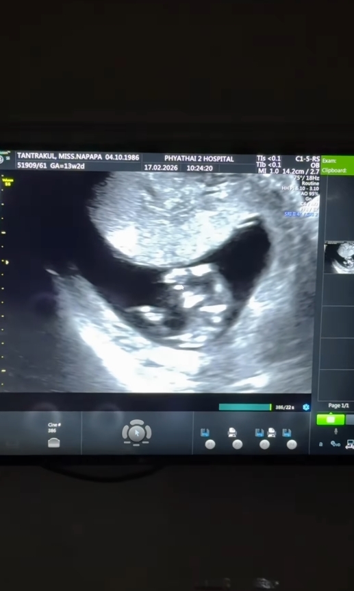 แพท ณปภา