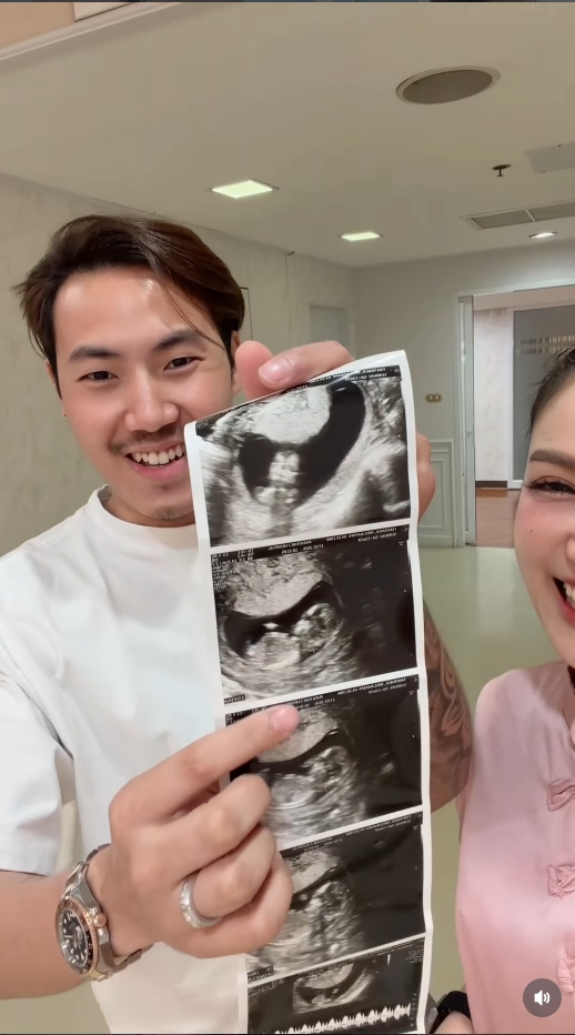 แพท ณปภา