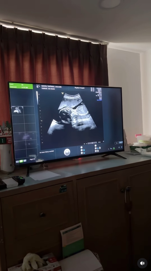 แพท ณปภา