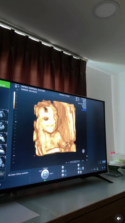 แพท ณปภา