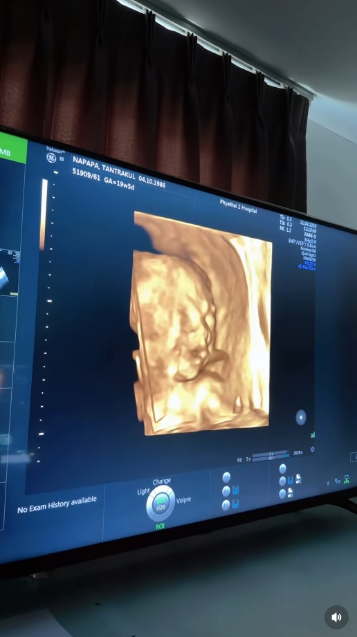 แพท ณปภา