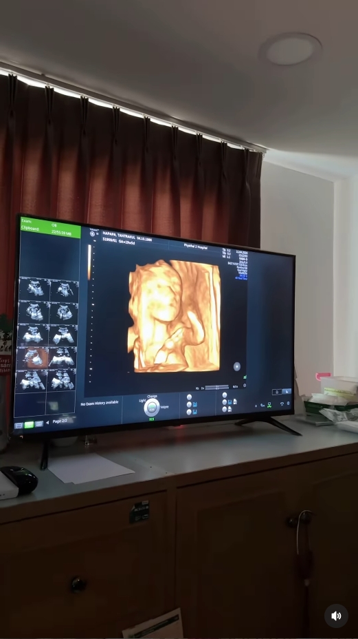 แพท ณปภา