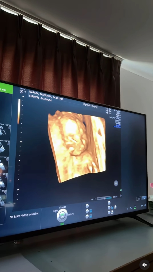 แพท ณปภา