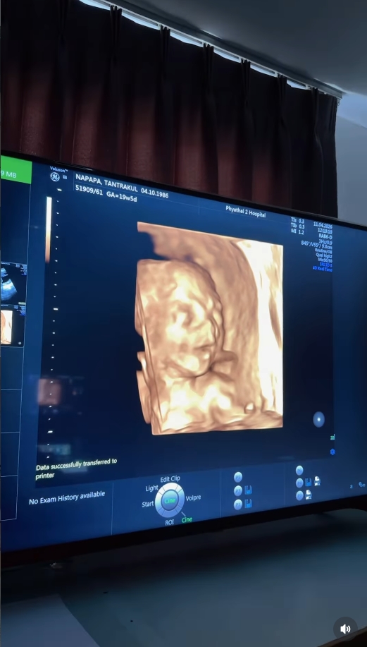 แพท ณปภา