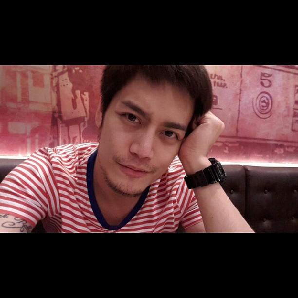 อ๊อฟ ปองศักดิ์ ศัลยกรรม