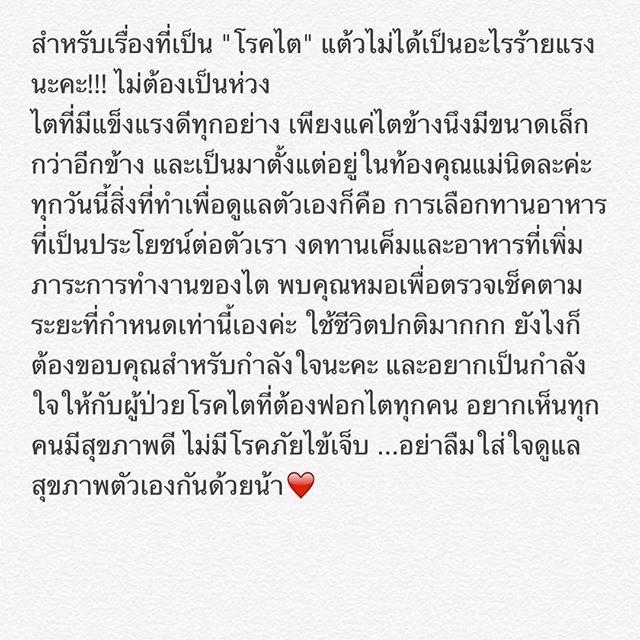 แต้ว ณฐพร