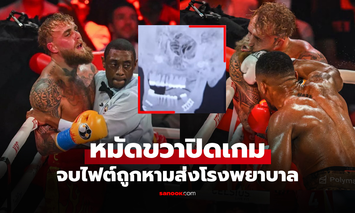 หนักเลย! "เจค พอล" ยูทูบเบอร์จอมเกรียนเผยพลังกำปั้น "โจชัว" ทำต้องผ่าตัดหลังจบไฟต์