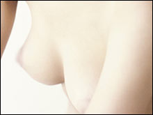 ตกแต่งหัวนม ลดปานนมให้เล็กลง