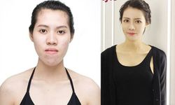 3 สาวไทยศัลยกรรมเปลี่ยนชีวิต ในรายการ Let me in
