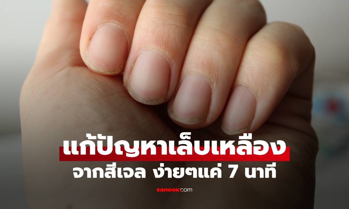 แก้ปัญหาเล็บเหลืองจากสีเจล ด้วยน้ำมันมะกอกอุ่น แช่แค่ 7 นาที