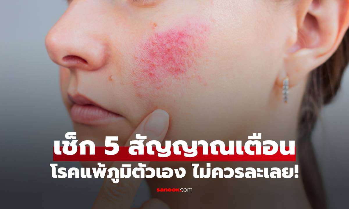 5 สัญญาณเตือน "โรคแพ้ภูมิตัวเอง" อาการเริ่มต้นที่ผู้หญิงห้ามละเลย ก่อนร่างกายพัง!