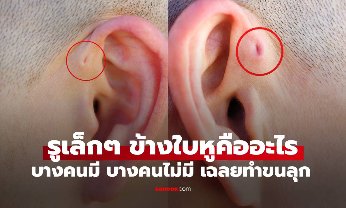 "รูเล็กๆ ข้างใบหู" เกิดจากอะไร ทำไมบางคนมีบางคนไม่มี อันตราย? เฉลยทำขนลุกเบาๆ