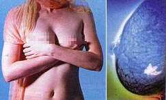 Thai Breast Friends เพื่อนแท้ของผู้หญิง