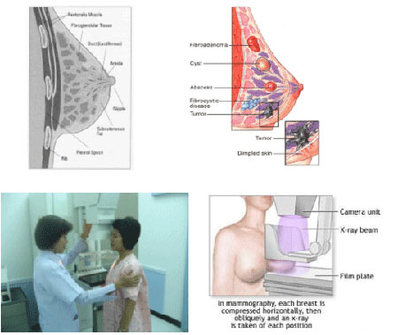 คุณรู้จัก เต้านม ของคุณดีหรือยัง