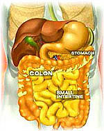 มะเร็งลำไส้ใหญ่