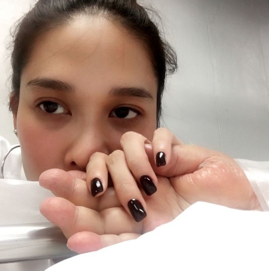 ดาราหน้าผากกว้าง