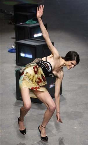 นางแบบล้ม