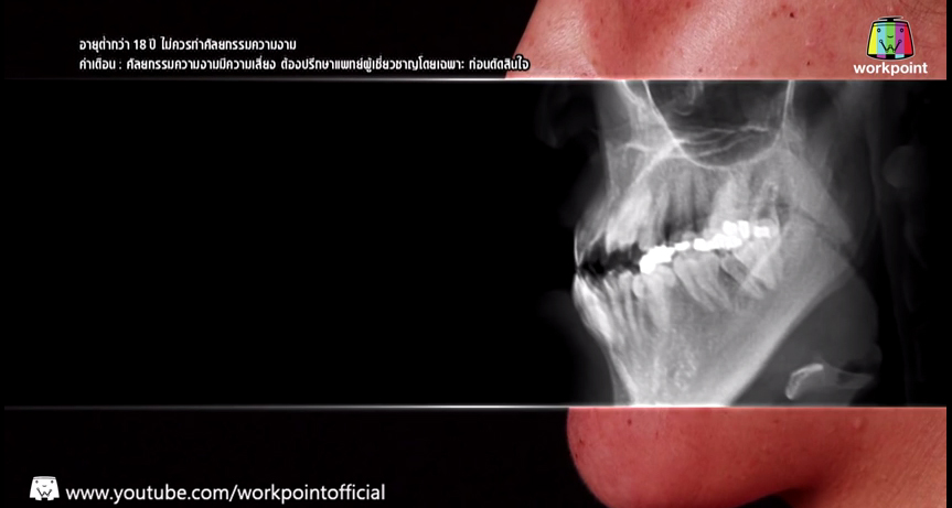 เอฟ วลีรัจน์ let me in