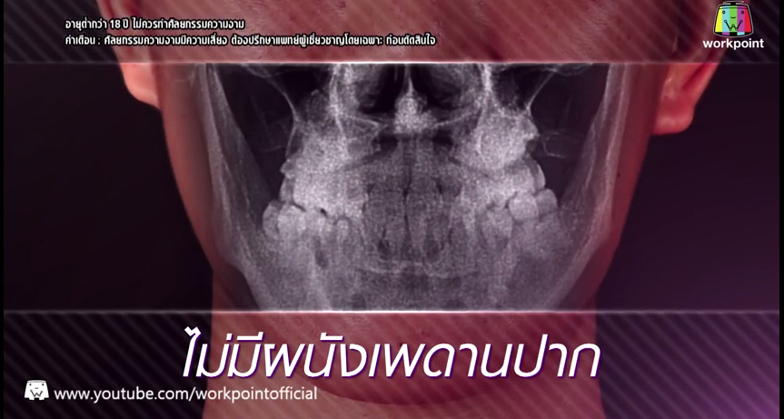 เอฟ วลีรัจน์ let me in