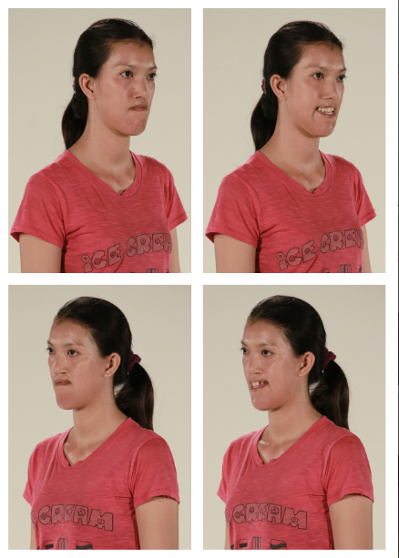 เอฟ วลีรัจน์ let me in