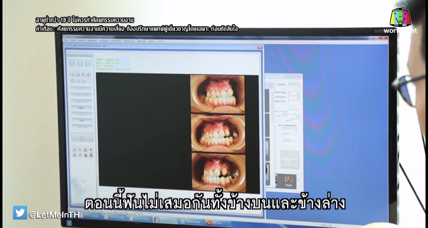 เอฟ วลีรัจน์ let me in